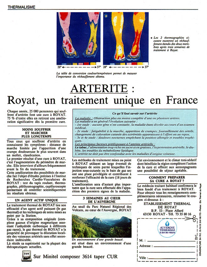 Marque ZxDiversCures 1987